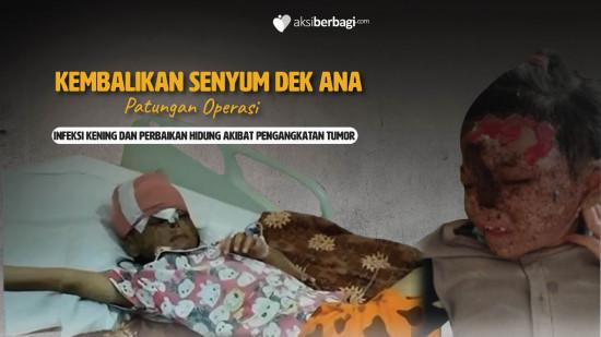 Segera! Patungan Bantu Dek Ana Tersenyum Kembali