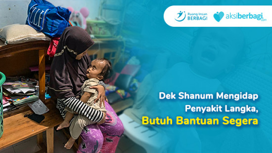 Dek Shanum Mengidap Penyakit Langka, Bantuan Biaya Operasi Segera!